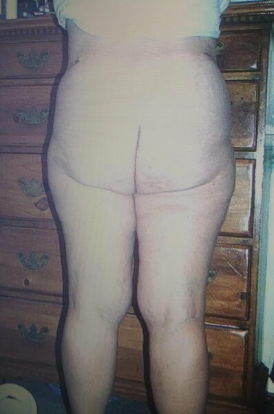 an old picture of my mom's naked butt.